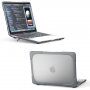 Na udarce odporen pokrov z nagibnimi nogami za MacBook Pro 13" (A2251 / A2289 / A2338) - siva
